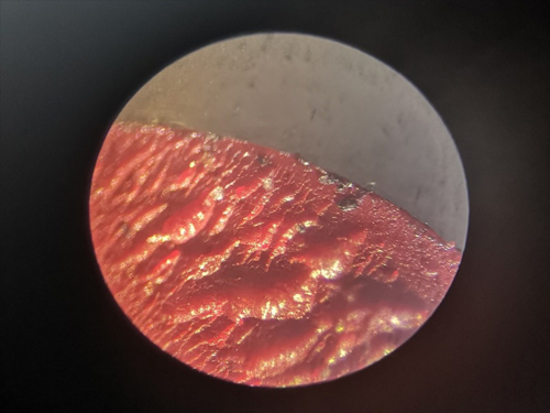 Pigmentdispersion unter dem Mikroskop